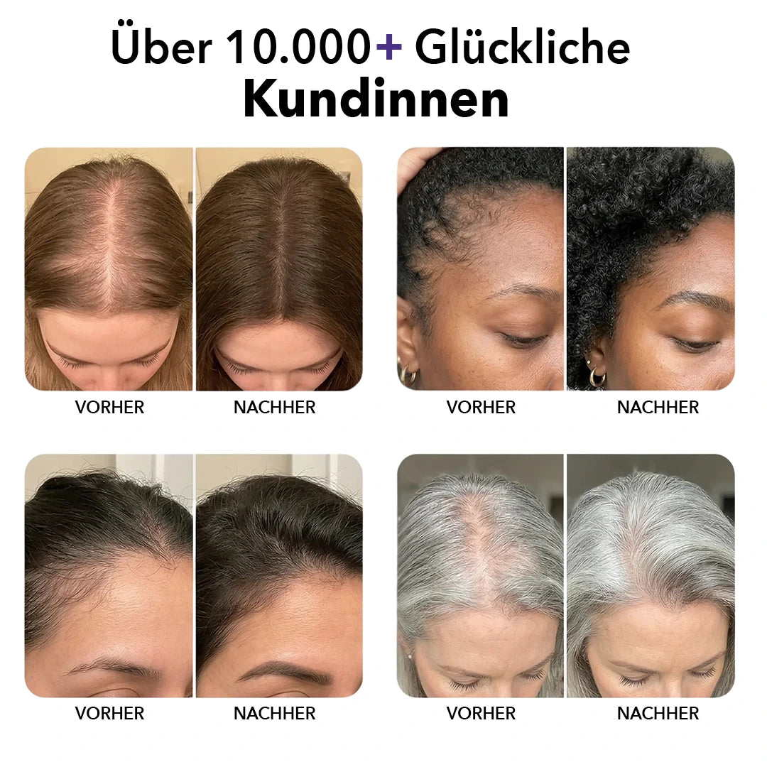 RootCare - Next Roll-on Haarwachstum Serum w
