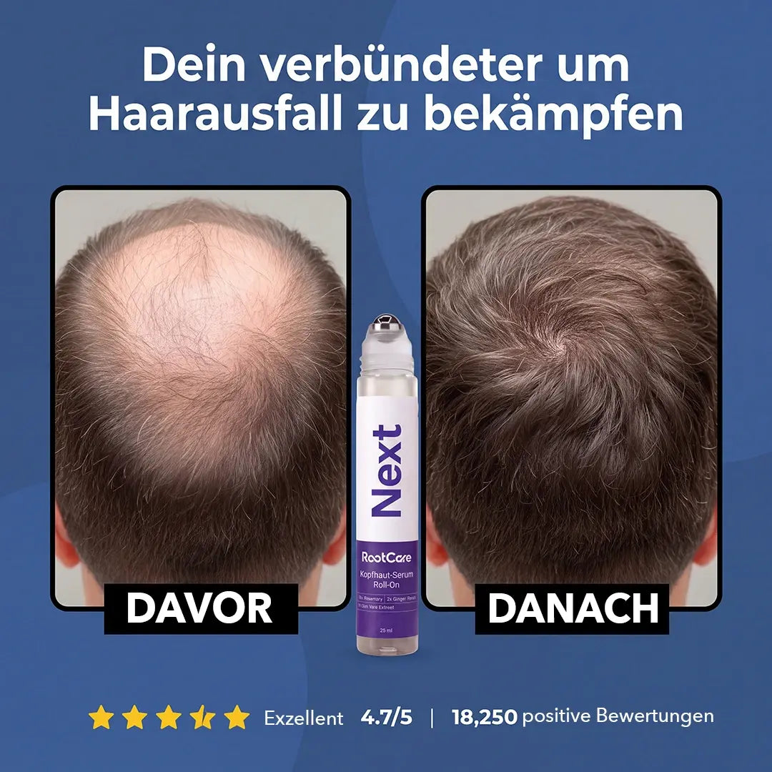 RootCare - Next Roll-on Haarwachstum Serum