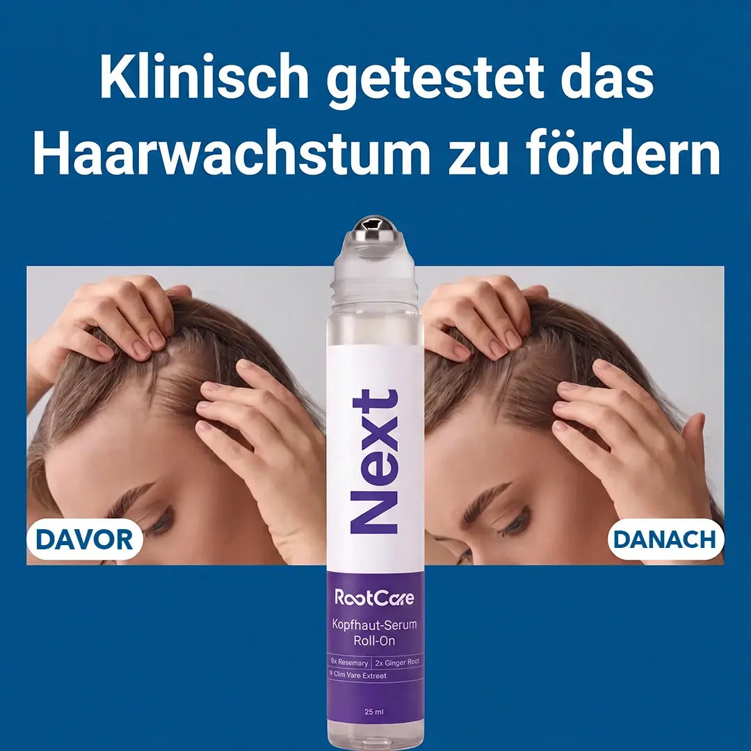RootCare - Next Roll-on Haarwachstum Serum