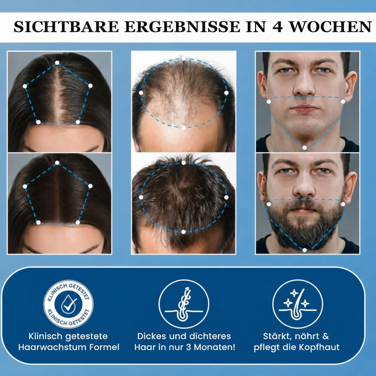 RootCare - Next Roll-on Haarwachstum Serum