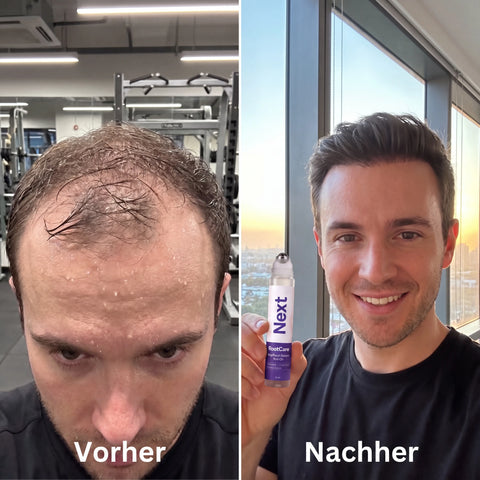 Vorher / Nachher