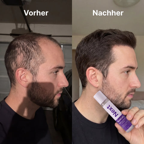 Vorher / Nachher